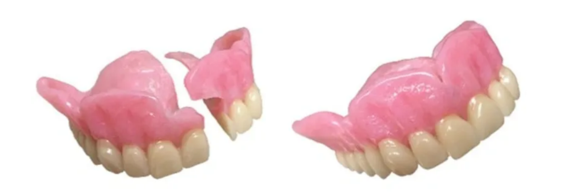Broken denture pieces showing damage that can be repaired at Comfy Denture Clinic