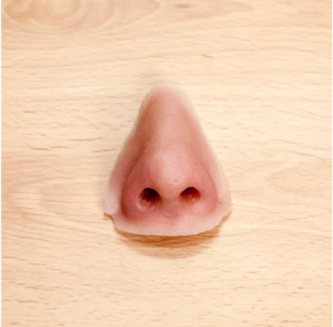 Custom nasal prosthesis crafted to restore natural appearance after nasal tissue loss